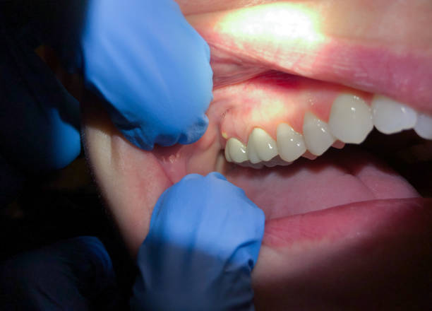 Best Orthodontic Emergency Dentist in Galls, IN